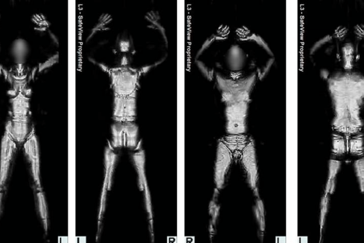 Body Imaging