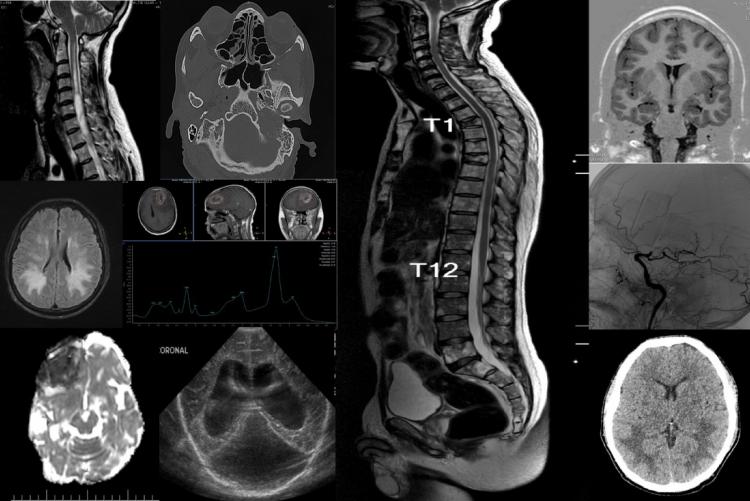 Neuroradiology Brain Radiology Key