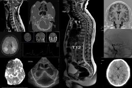 Neuroradiology