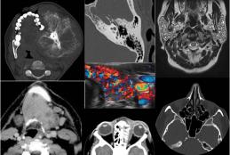 Head & Neck Imaging